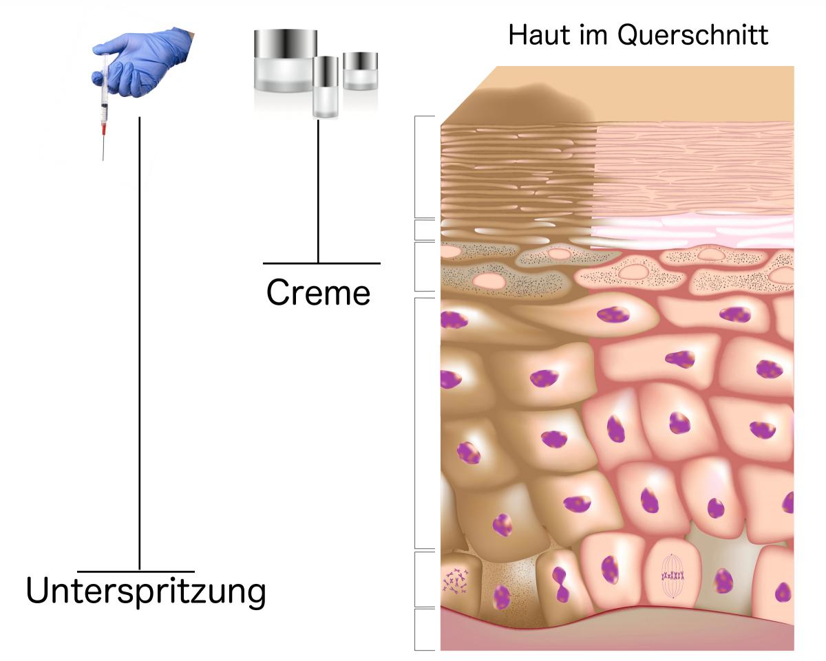 Schaubild tiefe der Wirkung Hyaluronsäure und Hyaluron Creme